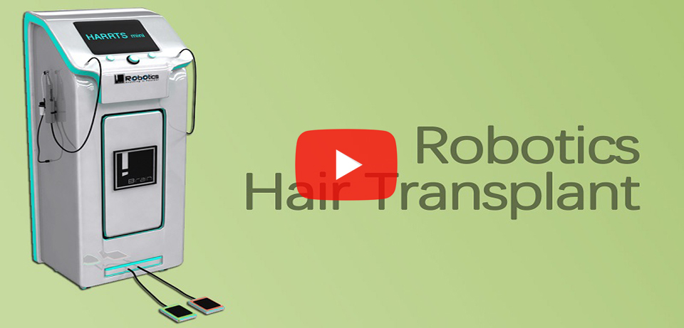 Robotics Hair Transplant