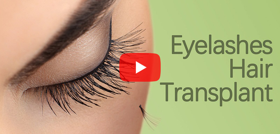 Eyelashes Hair Transplant in Surat, Gujarat (India)